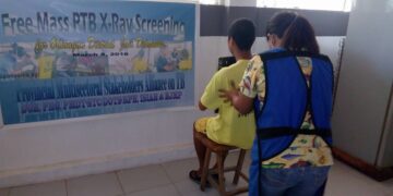 Odiongan District Jail detainees receives free PTB X-Ray Screening
