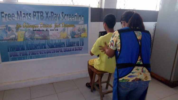 Odiongan District Jail detainees receives free PTB X-Ray Screening
