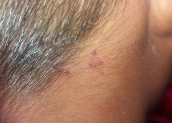 Gurong nanakit ng estudyante, humingi ng tawad at paumanhin