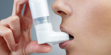 Study identifies genetic causes of asthma, hay fever, eczema