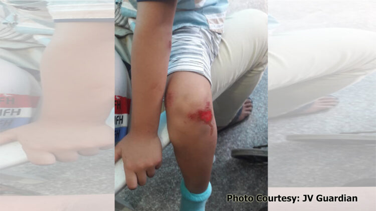 Mag-anak sa Ferrol, sugatan matapos maaksidente sa araw ng Pasko