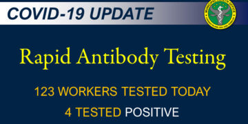 4 na manggagawa sa San Jose na nagpa-Rapid Test, nagpositibo