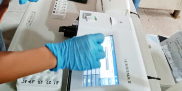 Positibong resulta ng Antigen, iuuri na bilang kumpirmadong kaso ng COVID-19
