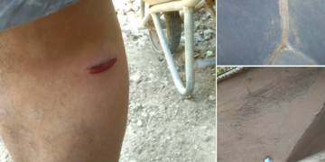 Isang sibilyan, sugatan sa barilan ng pulis at armadong suspek sa Odiongan