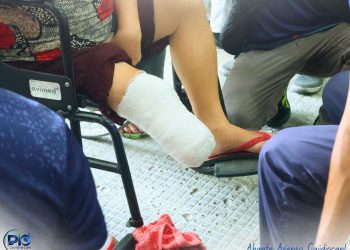 21 PWD sa Sibuyan, sinukatan para sa libreng prosthetic arms at legs